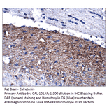 Anti-Calretinin Antibody from FabGennix (CAL-101AP) - Antibodies.com