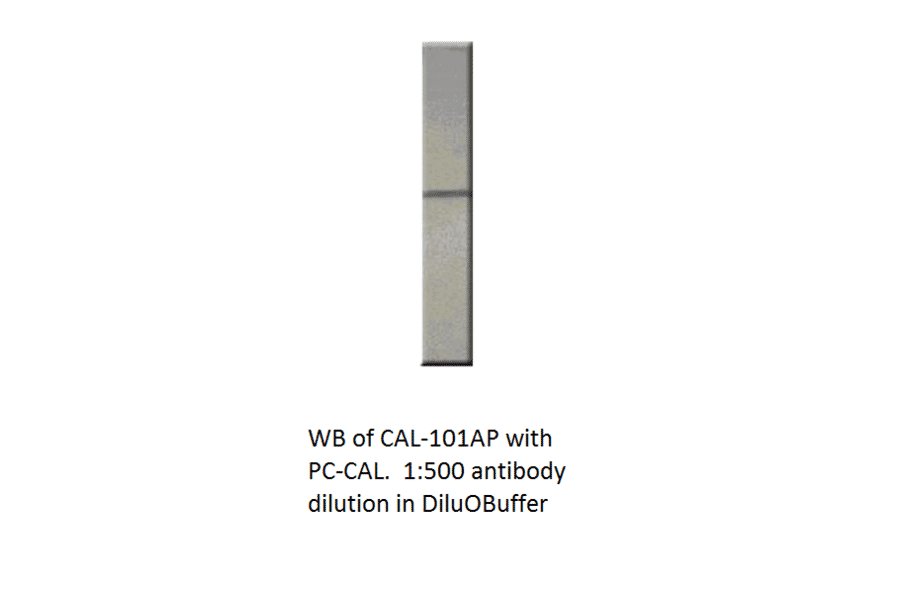 Anti-Calretinin Antibody from FabGennix (CAL-101AP) - Antibodies.com
