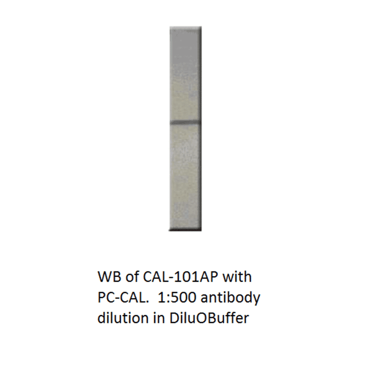 Anti-Calretinin Antibody from FabGennix (CAL-101AP) - Antibodies.com