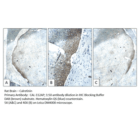 Anti-Calretinin Antibody from FabGennix (CAL-112AP) - Antibodies.com