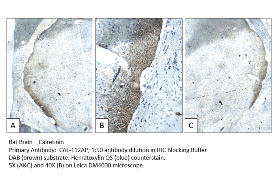 Anti-Calretinin Antibody from FabGennix (CAL-112AP) - Antibodies.com