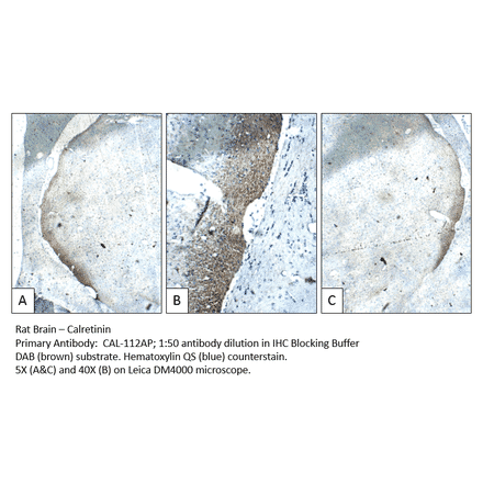 Anti-Calretinin Antibody from FabGennix (CAL-112AP) - Antibodies.com