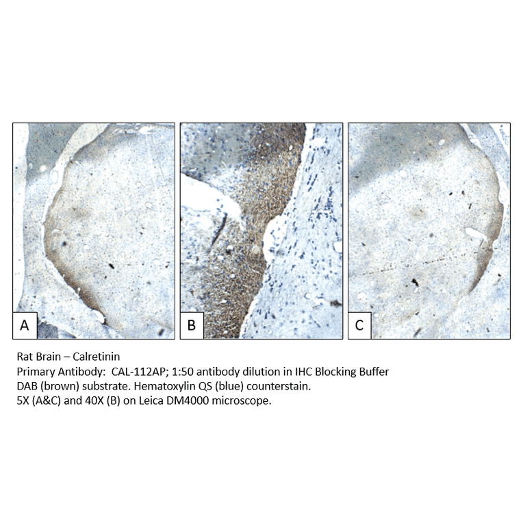 Anti-Calretinin Antibody from FabGennix (CAL-112AP) - Antibodies.com