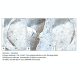 Anti-Calretinin Antibody from FabGennix (CAL-112AP) - Antibodies.com