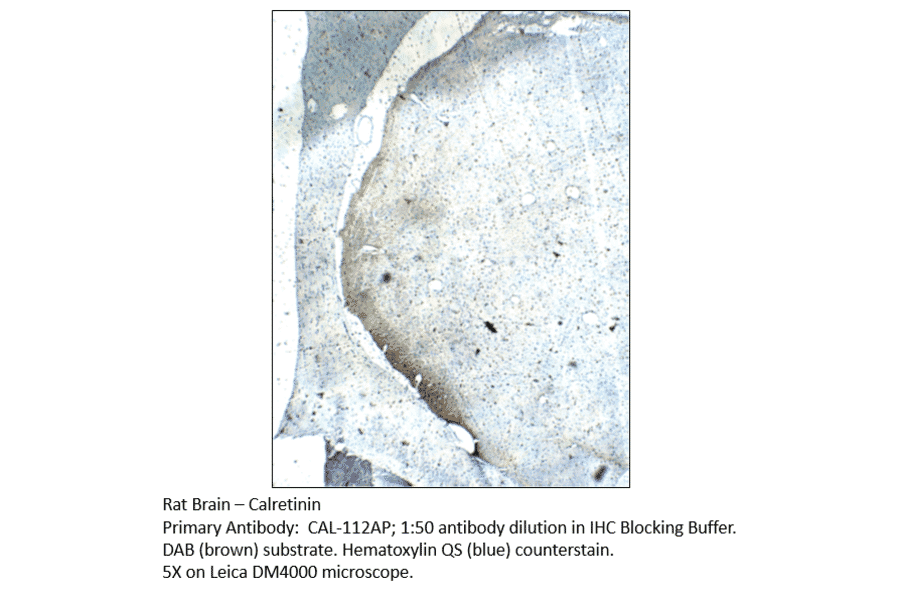 Anti-Calretinin Antibody from FabGennix (CAL-112AP) - Antibodies.com