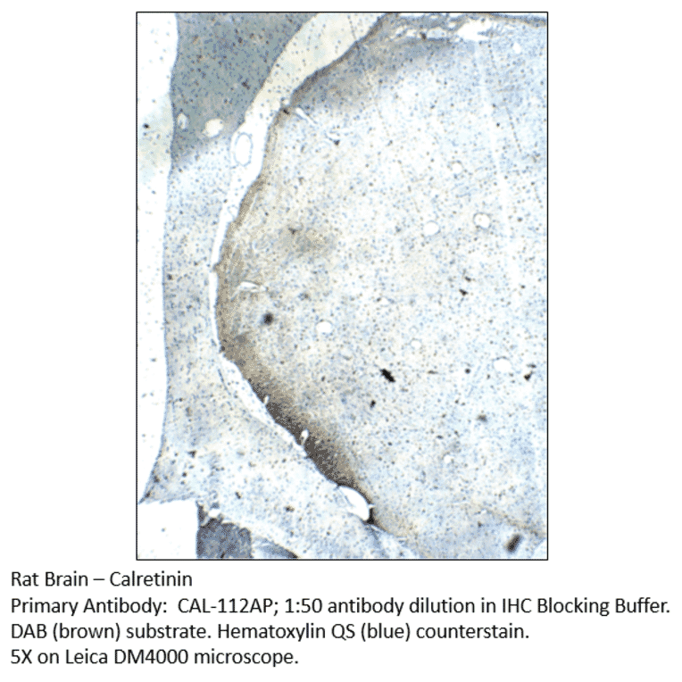 Anti-Calretinin Antibody from FabGennix (CAL-112AP) - Antibodies.com