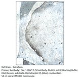 Anti-Calretinin Antibody from FabGennix (CAL-112AP) - Antibodies.com