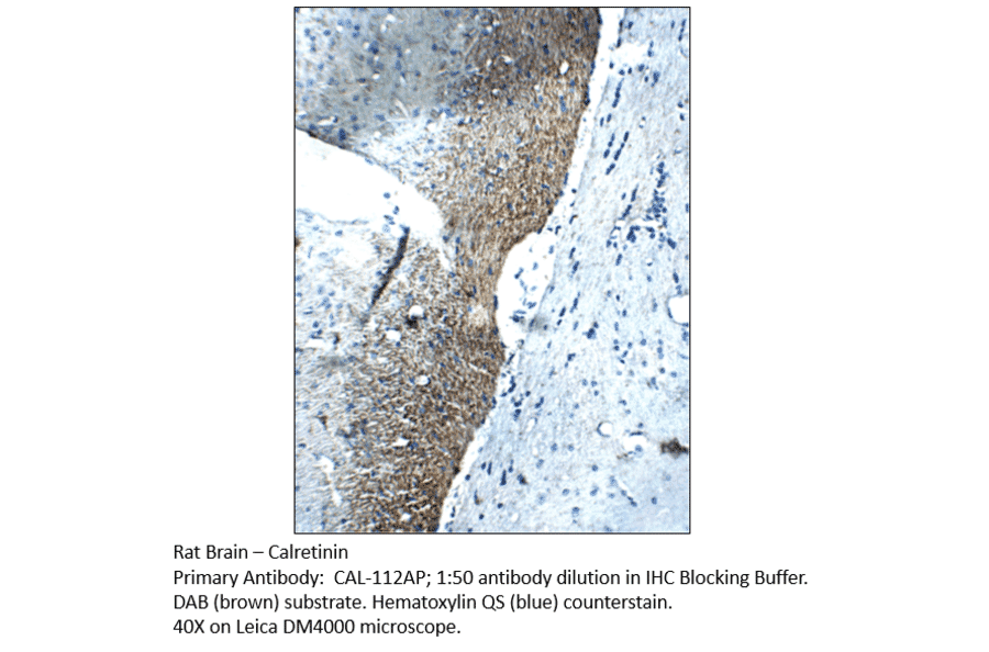 Anti-Calretinin Antibody from FabGennix (CAL-112AP) - Antibodies.com