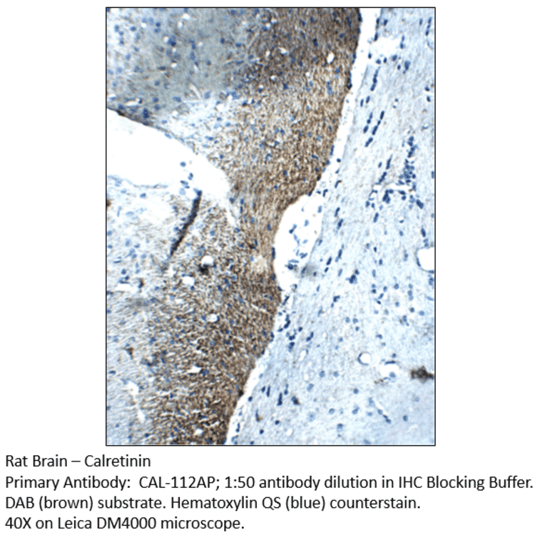 Anti-Calretinin Antibody from FabGennix (CAL-112AP) - Antibodies.com