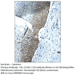 Anti-Calretinin Antibody from FabGennix (CAL-112AP) - Antibodies.com