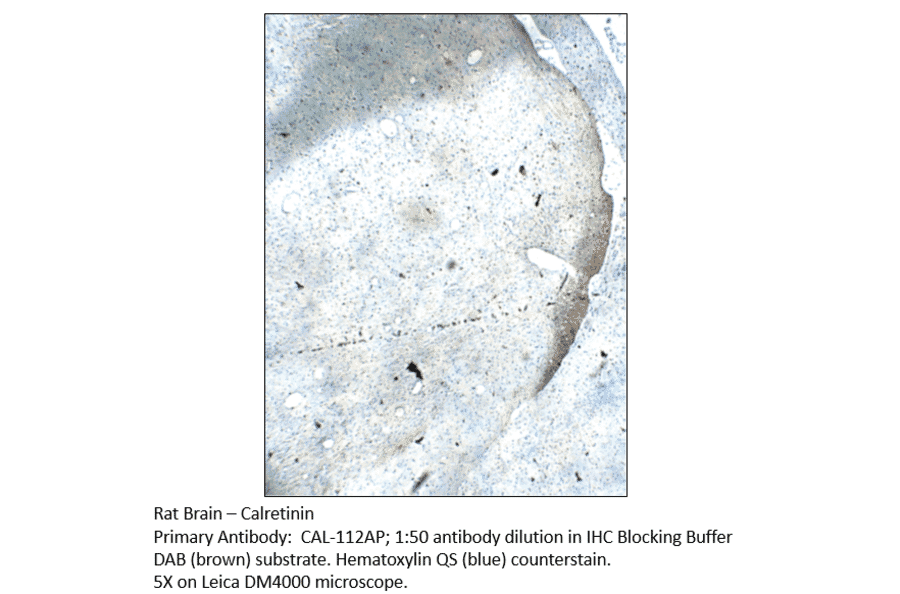 Anti-Calretinin Antibody from FabGennix (CAL-112AP) - Antibodies.com