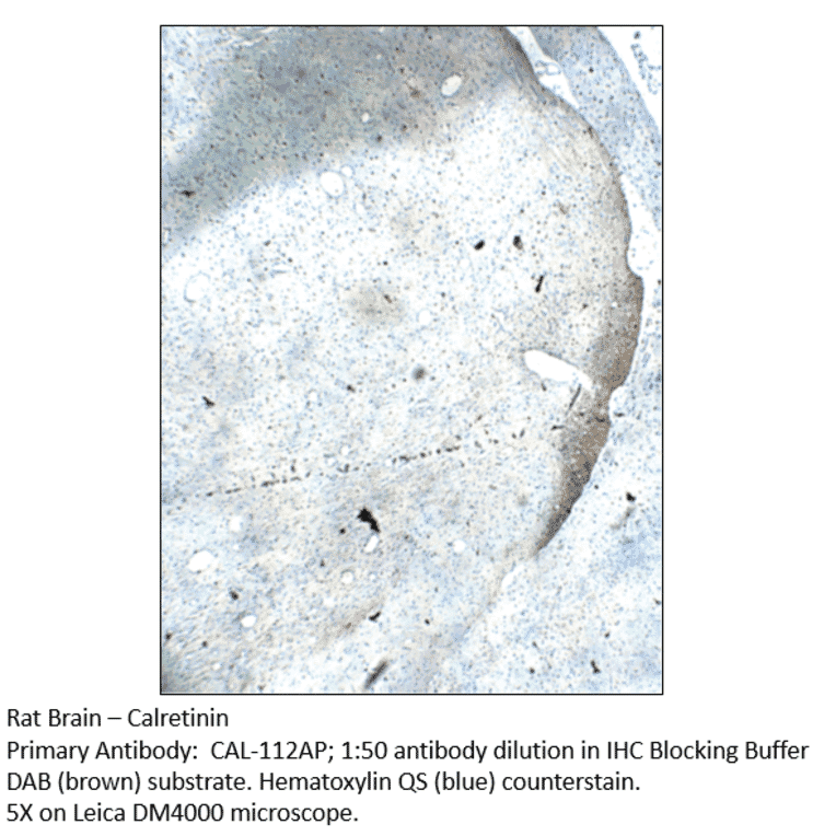 Anti-Calretinin Antibody from FabGennix (CAL-112AP) - Antibodies.com
