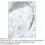 Anti-Calretinin Antibody from FabGennix (CAL-112AP) - Antibodies.com