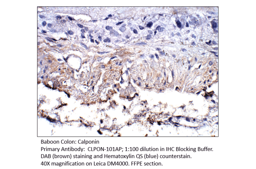 Anti-Calponin Antibody from FabGennix (CLPON-101AP) - Antibodies.com