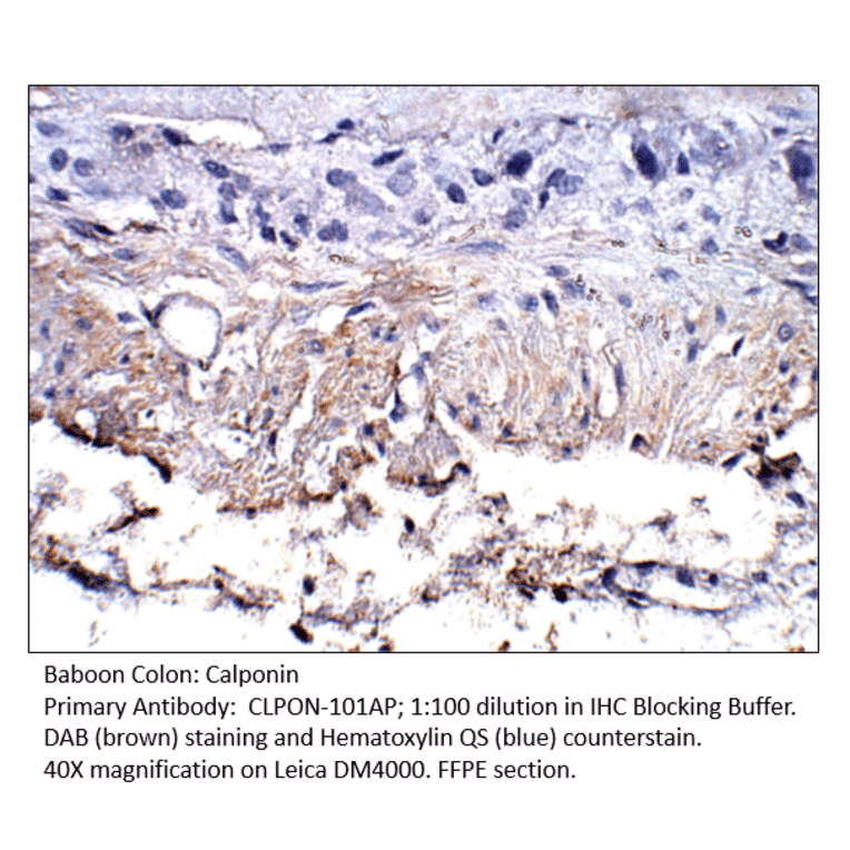 Anti-Calponin Antibody from FabGennix (CLPON-101AP) - Antibodies.com