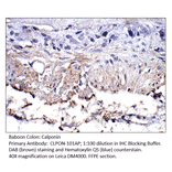 Anti-Calponin Antibody from FabGennix (CLPON-101AP) - Antibodies.com