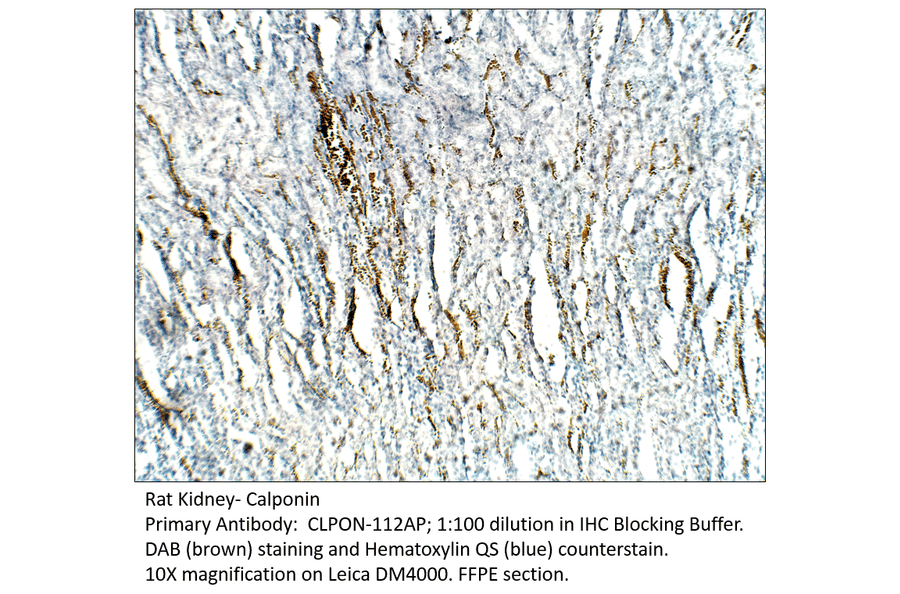 Anti-Calponin Antibody from FabGennix (CLPON-112AP) - Antibodies.com