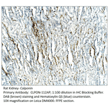 Anti-Calponin Antibody from FabGennix (CLPON-112AP) - Antibodies.com