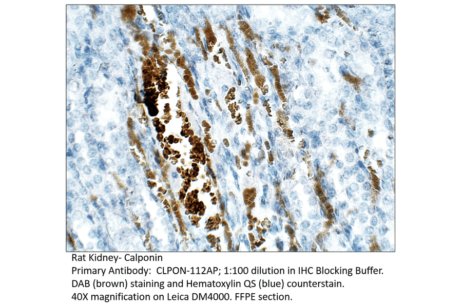 Anti-Calponin Antibody from FabGennix (CLPON-112AP) - Antibodies.com