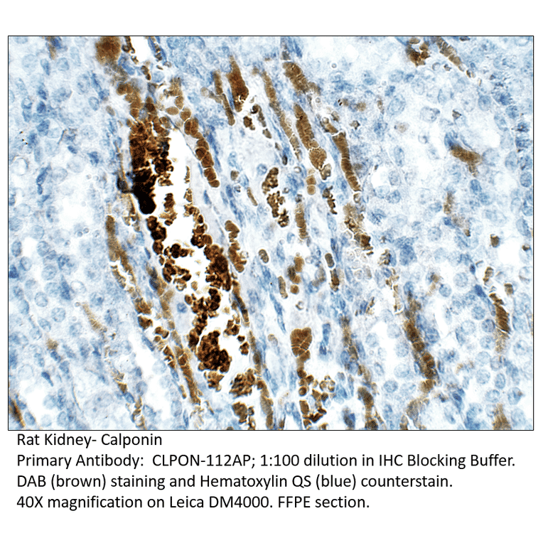 Anti-Calponin Antibody from FabGennix (CLPON-112AP) - Antibodies.com