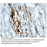 Anti-Calponin Antibody from FabGennix (CLPON-112AP) - Antibodies.com