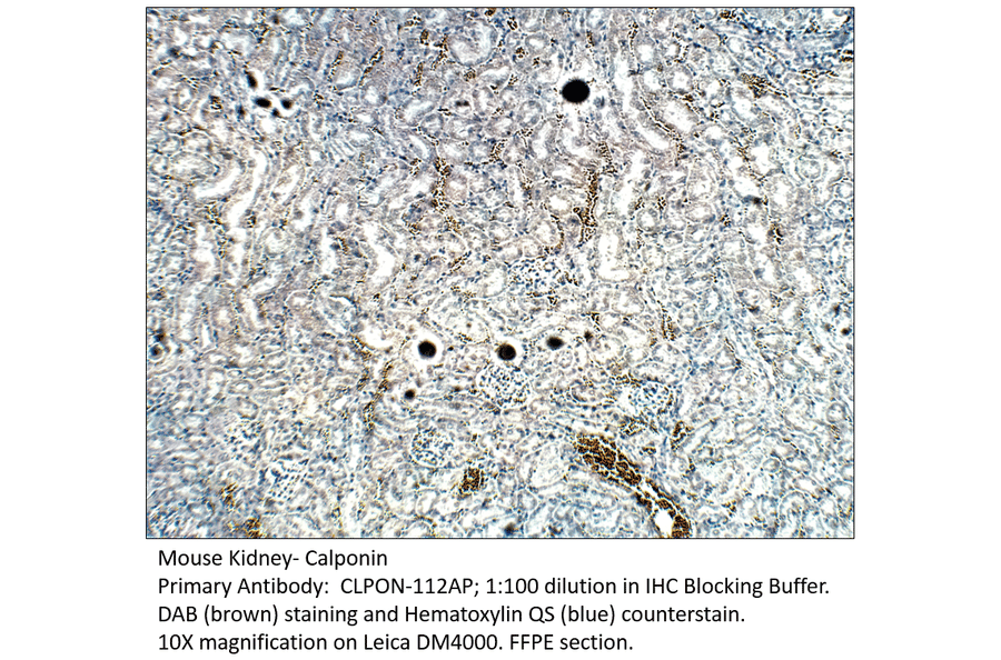Anti-Calponin Antibody from FabGennix (CLPON-112AP) - Antibodies.com