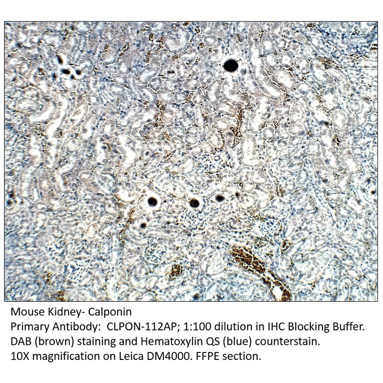 Anti-Calponin Antibody from FabGennix (CLPON-112AP) - Antibodies.com