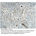 Anti-Calponin Antibody from FabGennix (CLPON-112AP) - Antibodies.com