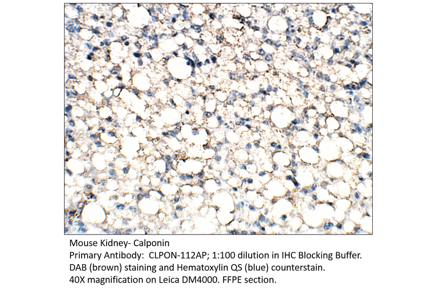Anti-Calponin Antibody from FabGennix (CLPON-112AP) - Antibodies.com