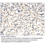 Anti-Calponin Antibody from FabGennix (CLPON-112AP) - Antibodies.com