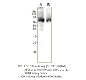 Anti-GLUT12 Antibody from FabGennix (GLUT12-1201AP) - Antibodies.com