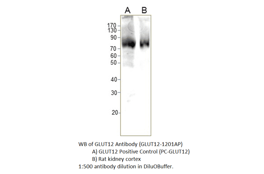 Anti-GLUT12 Antibody from FabGennix (GLUT12-1201AP) - Antibodies.com