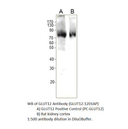 Anti-GLUT12 Antibody from FabGennix (GLUT12-1201AP) - Antibodies.com