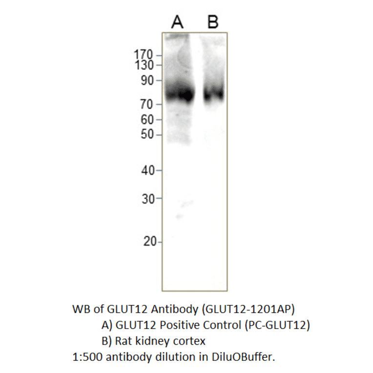 Anti-GLUT12 Antibody from FabGennix (GLUT12-1201AP) - Antibodies.com