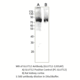 Anti-GLUT12 Antibody from FabGennix (GLUT12-1201AP) - Antibodies.com