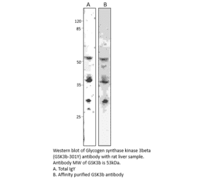 Anti-GSK3 beta Antibody from FabGennix (GSK3B-301Y) - Antibodies.com
