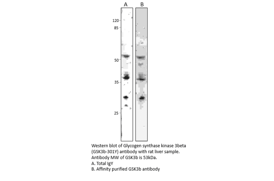 Anti-GSK3 beta Antibody from FabGennix (GSK3B-301Y) - Antibodies.com