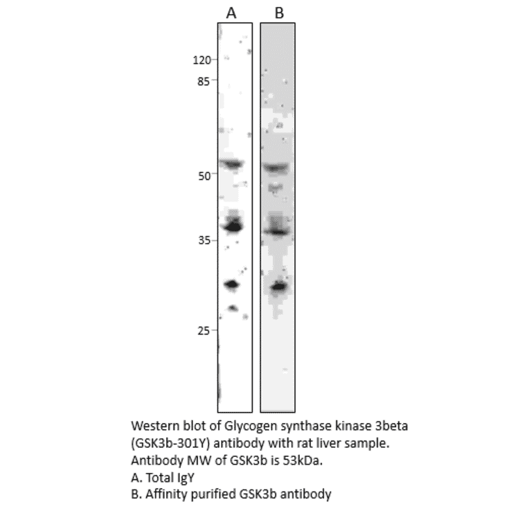 Anti-GSK3 beta Antibody from FabGennix (GSK3B-301Y) - Antibodies.com
