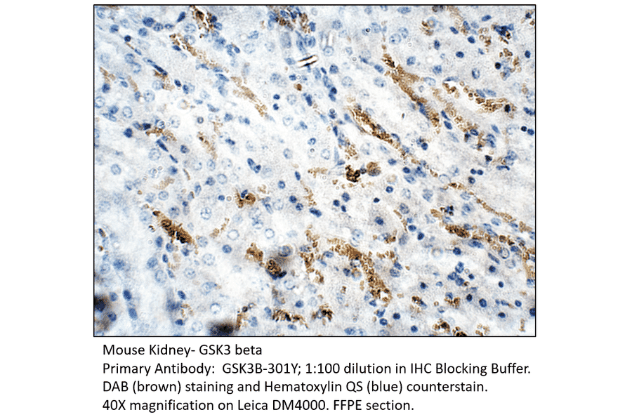 Anti-GSK3 beta Antibody from FabGennix (GSK3B-301Y) - Antibodies.com
