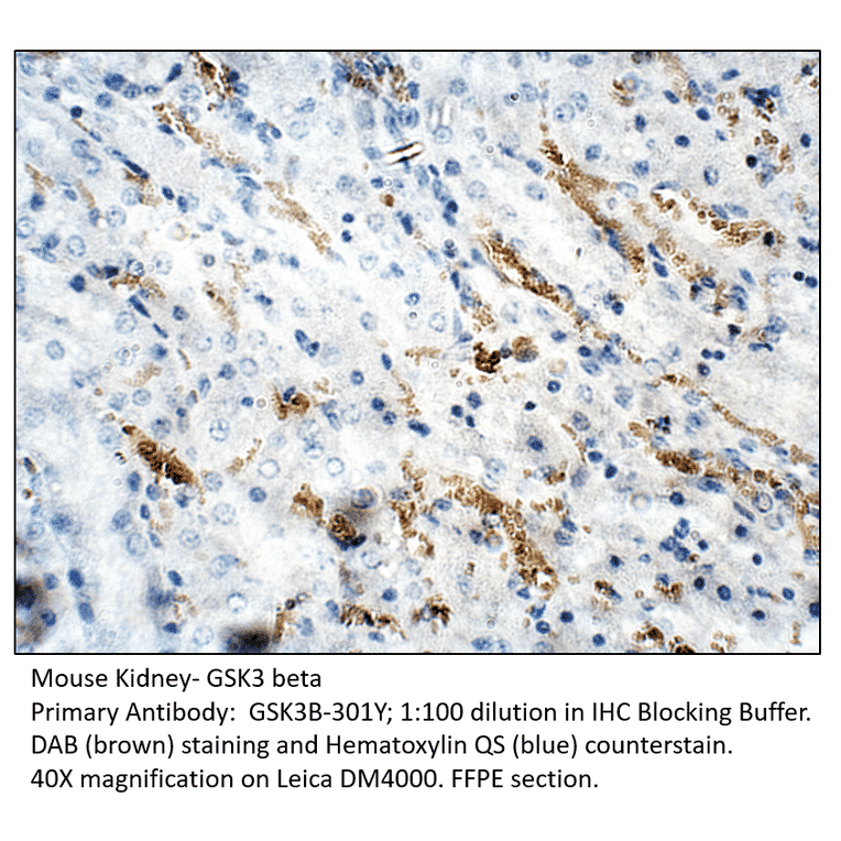 Anti-GSK3 beta Antibody from FabGennix (GSK3B-301Y) - Antibodies.com