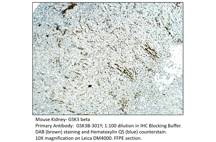 Anti-GSK3 beta Antibody from FabGennix (GSK3B-301Y) - Antibodies.com