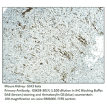 Anti-GSK3 beta Antibody from FabGennix (GSK3B-301Y) - Antibodies.com