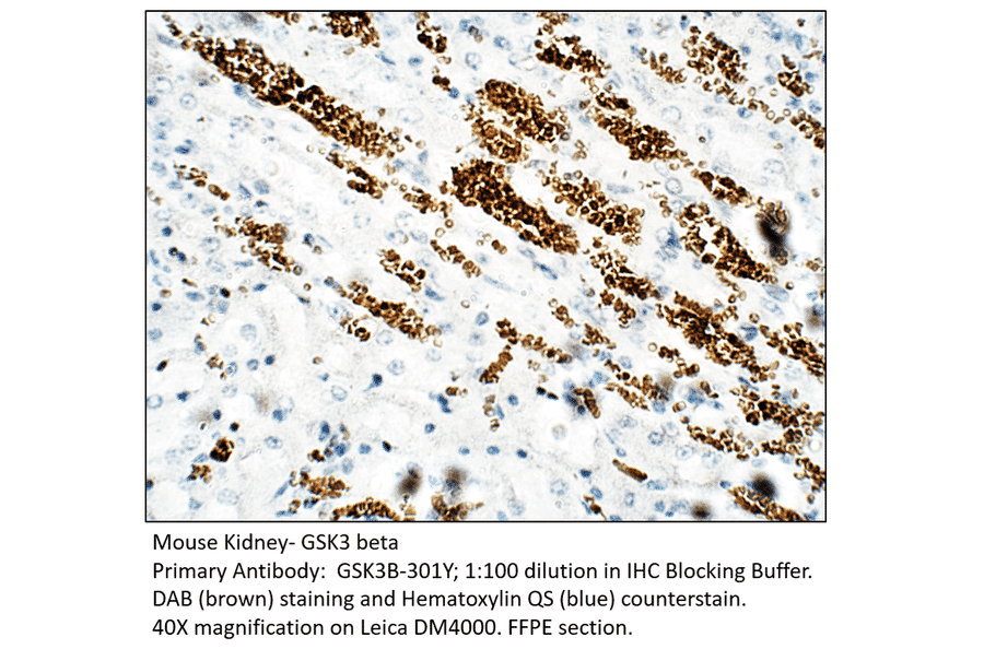Anti-GSK3 beta Antibody from FabGennix (GSK3B-301Y) - Antibodies.com