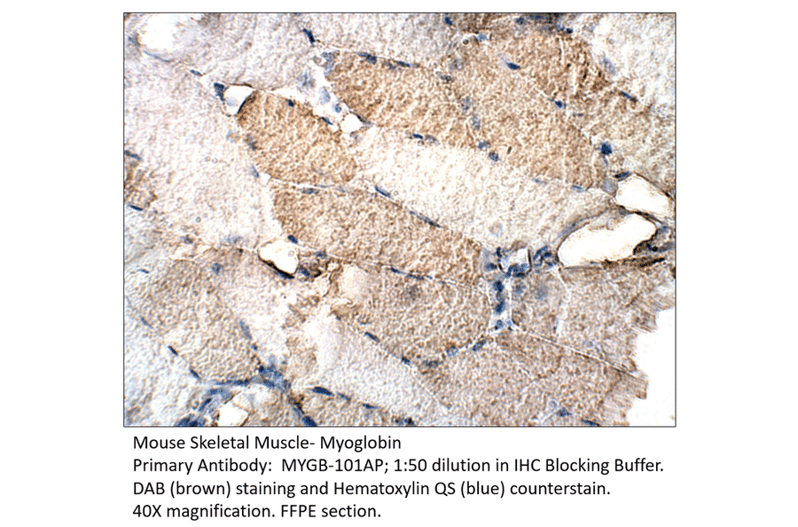 Anti-Myoglobin Antibody from FabGennix (MYGB-101AP) - Antibodies.com