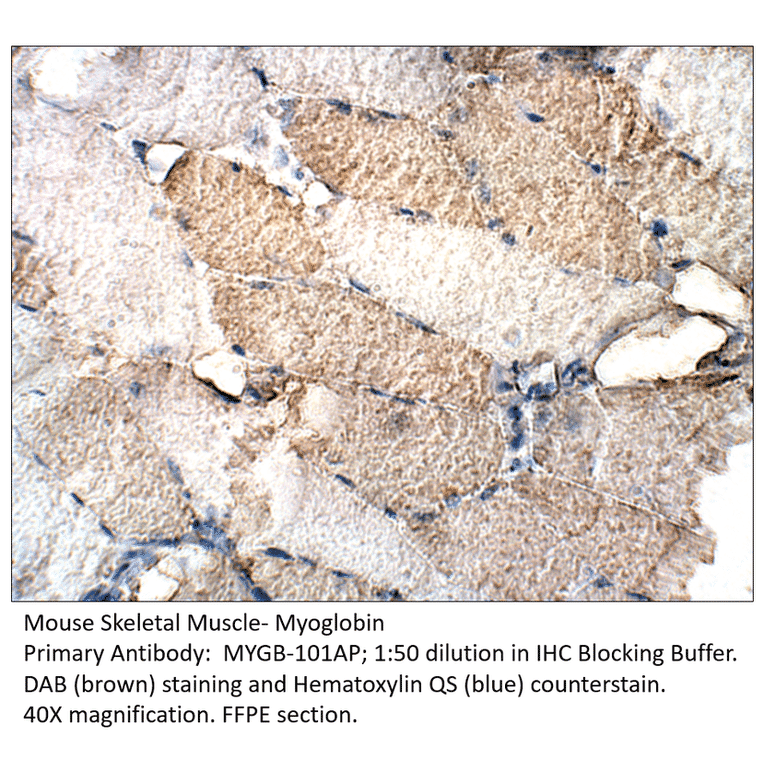 Anti-Myoglobin Antibody from FabGennix (MYGB-101AP) - Antibodies.com