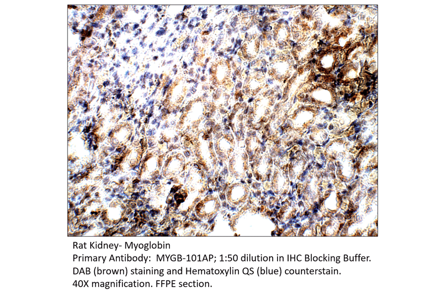 Anti-Myoglobin Antibody from FabGennix (MYGB-101AP) - Antibodies.com