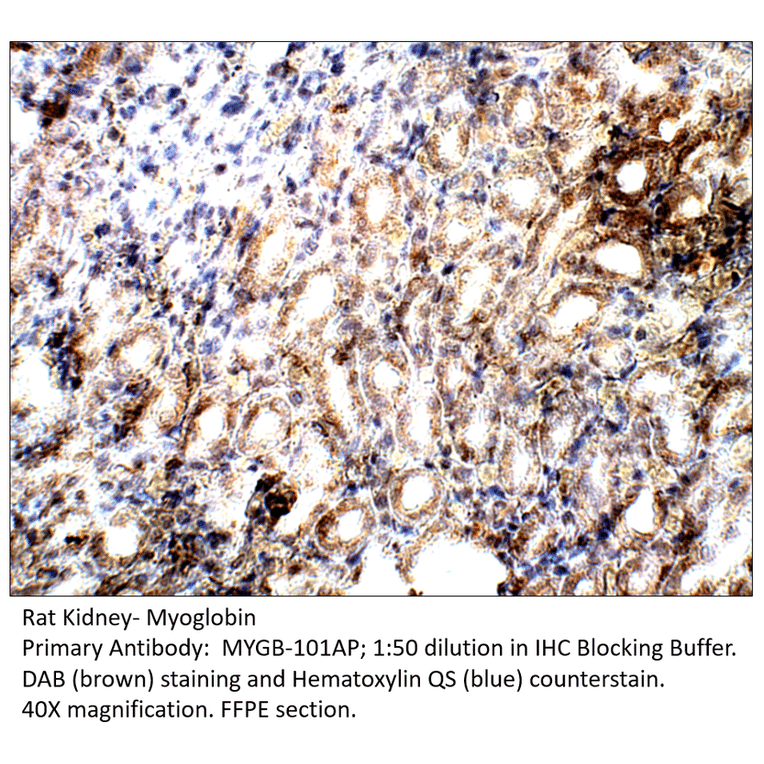 Anti-Myoglobin Antibody from FabGennix (MYGB-101AP) - Antibodies.com