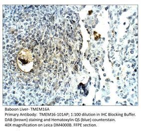 Anti-TMEM16A Antibody from FabGennix (TMEM16-101AP) - Antibodies.com