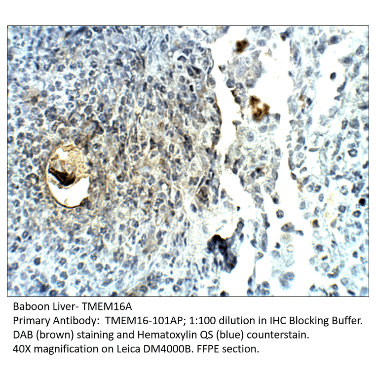 Anti-TMEM16A Antibody from FabGennix (TMEM16-101AP) - Antibodies.com