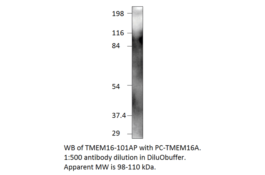 Anti-TMEM16A Antibody from FabGennix (TMEM16-101AP) - Antibodies.com